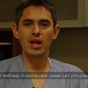 Radiation Therapy What Are The Side Effects The Patient Story