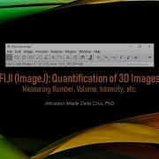 FIJI ImageJ Quantification Of 3D Images Measuring Number Volume Intensity Etc On Z Stacks