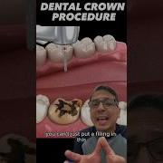 Restoring Worn Out Teeth With A Dental Crown EXPLAINED View Mobile Dental