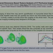 4 Fractal Dimension Based Texture Analysis Of CT Perfusion Imaging