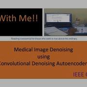 Stacked Denoising Autoencoders Studywithme Researcharticleread Shalininitt