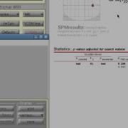 Quick And Efficient ROI Analysis In SPM Part 1
