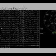 Using SLORETA And ZBuilder To Image Brain Activation