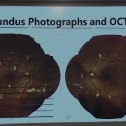 AIOC 2026 IC87 T Д р Джей Шет Мультимодальная визуализация против только ОКТ инновация или изл