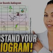 Audiogram Basics Why These Symbols Matter For Your Hearing