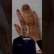 1 3000 Most Common Limb Malformation Shorts