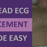 12 Lead ECG Placement Made Easy Nursing EKG Electrodes Interpretation