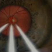 Warum Hat Man Auf Fotos Rote Augen Wissen Vor Acht
