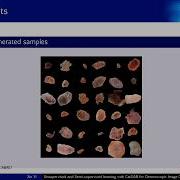 Supervised And Semi Supervised Learning With CatGAN For Dermoscopy Image Classification