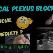 SUPERFICIAL CERVICAL PLEXUS BLOCK ULTRASOUND GUIDED LANDMARK LOR TIPS TRICKS