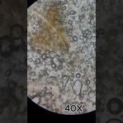 Ever Seen A Banana Under A Microscope BananaCloseUp MicroscopeMagic FruitZoom CuriousMinds