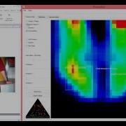 Precision S PS 256 Pressure Mapping Clinical Tutorial Wheelchair Seating