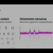 Chromosome Microarray CMA Testing