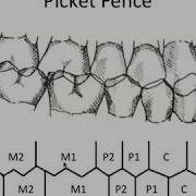 STATIC OCCLUSION Occlusal Contacts Picket Fence