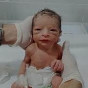 Cute Low Birth Weight Baby First Feeding Try NICU Care Newboranbaby Neonatologist Cute