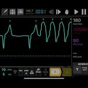 Defibrillation And Cardioversion