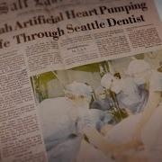 University Of Utah Remembers Groundbreaking 1982 Artificial Heart Surgery