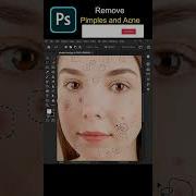 Remove Pimples And Acne Photoshop Tutorials Shorts