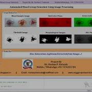 Matlab Code For Blood Group Detection And Classification Using Image Processing