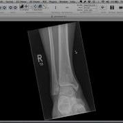 Tips Tricks For Using OsiriX To Examine In Dual Screen Mode