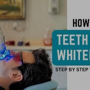 How To Do Teeth Whitening