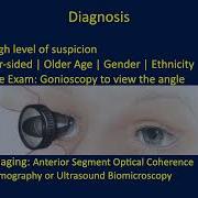 Narrow Angle And Pupillary Block Angle Closure