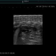 Echo Images Heart Blood Veseels Liver And Bladder And ECG In A Ball Python 蛇のエコーと心電図