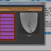 Matlab Projects On Image Processing With Source Code