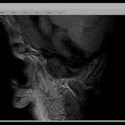 5 Import Of MRI Data