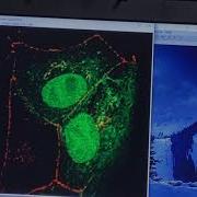 Confocal Image Processing Analysis Using ImageJ