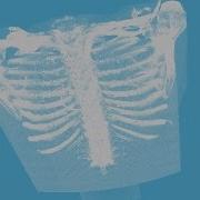 Volume Visualization App MATLAB Video