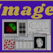 Step By Step Guide How To Use ImageJ For Image Analysis
