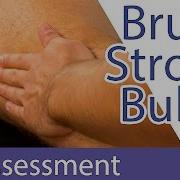 Brush Stroke Bulge Swipe Test Knee Swelling
