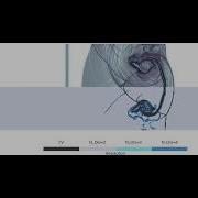 Mach 6 Shock Helium Bubble Interaction Hp Adaptive Diffuse Interface