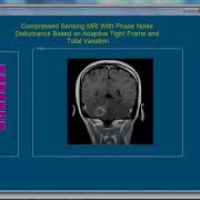 Digital Image Processing Projects For Final Year Digital Image Processing Thesis For Final Year
