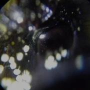 Bumble Bee Under The Microscope