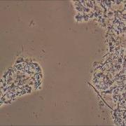 Killing Bacteria Naturally With Salt