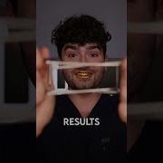 Gold ASMR Snacks Vs Cavities