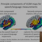 Multivariate Analysis Of Neuroimaging Data Applications For Stroke Research Grigori Yourganov