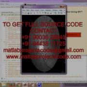 Iris Recognition Based On Human Interpretable Features