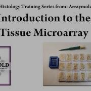 How To Create A Tissue Microarray Block