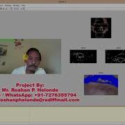 Matlab Code For Driver Drowsiness Detection Using Image Processing