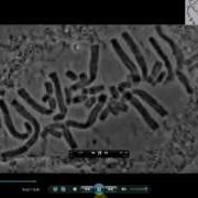 Real Microscopic Mitosis MRC