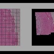 Microscopy 2D Tiles Image Stitching