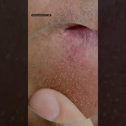 Whitening Capsules Demo Gbcosmatics Capsule Whiteningcapsules Whitening Urgentwhitening