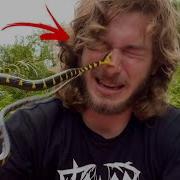 Venomous Snake Bite To The FACE