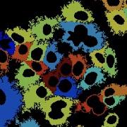 Basic Use Of CellProfiler
