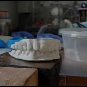 Этап 2 Муляж зубного протеза Бабочка Работа с полимерным термопластиком Polymorph