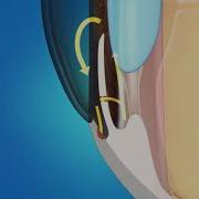 What Happens During Laser Iridotomy Surgery