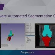 Simpleware Automated Segmentation Solution Synopsys